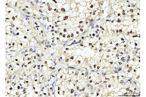 IHC analysis of PCNA using anti-PCNA antibody (ABIN7599181).