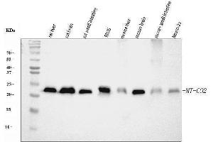 Western blot analysis of MT-CO2 using anti-MT-CO2 antibody (ABIN7599081). (COX2 anticorps  (AA 1-205))
