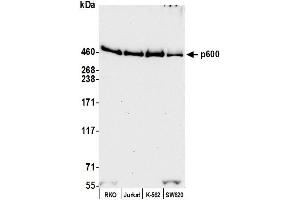 Western Blotting (WB) image for anti-Ubiquitin Protein Ligase E3 Component N-Recognin 4 (UBR4) (AA 5133-5183) antibody (ABIN7453830)