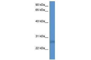 Western Blot showing SPSB2 antibody used at a concentration of 1-2 ug/ml to detect its target protein.