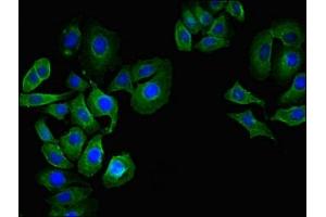 Immunofluorescent analysis of A549 cells using ABIN7148376 at dilution of 1:100 and Alexa Fluor 488-congugated AffiniPure Goat Anti-Rabbit IgG(H+L)