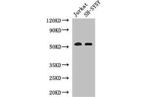 Western Blot Positive WB detected in: Jurkat whole cell lysate, SH-SY5Y whole cell lysate All lanes: TGFBR1 antibody at 4 μg/mL Secondary Goat polyclonal to rabbit IgG at 1/50000 dilution Predicted band size: 56, 57, 48 kDa Observed band size: 56 kDa (TGFBR1 anticorps  (AA 157-244))