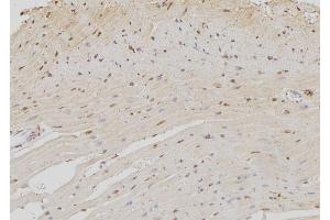ABIN6273372 at 1/100 staining Rat heart tissue by IHC-P. (NOC4L anticorps  (Internal Region))
