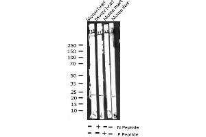 Western blot analysis of Phospho-CHOP (Ser30) expression in various lysates