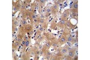 TRPM8 antibody immunohistochemistry analysis in formalin fixed and paraffin embedded human liver tissue. (TRPM8 anticorps  (AA 263-292))