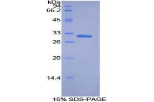 SDS-PAGE analysis of Mouse Torsin 3A Protein. (TOR3A Protéine)