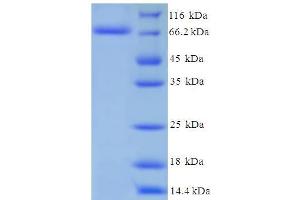 SDS-PAGE (SDS) image for Cytochrome P450, Family 11, Subfamily A, Polypeptide 1 (CYP11A1) (AA 40-521) protein (His-SUMO Tag) (ABIN5709377) (CYP11A1 Protein (AA 40-521) (His-SUMO Tag))