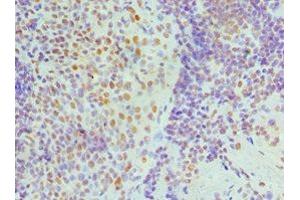 Immunohistochemistry of paraffin-embedded human tonsil tissue using ABIN7161690 at dilution of 1:100