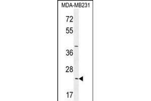 SYCE2 Antibody (N-term) (ABIN654371 and ABIN2844127) western blot analysis in MDA-M cell line lysates (35 μg/lane). (SYCE2 anticorps  (N-Term))