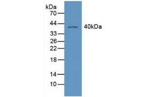 Detection of RXRg in Mouse Heart Tissue using Polyclonal Antibody to Retinoid X Receptor Gamma (RXRg)