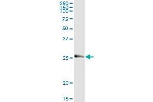 anti-Interferon, alpha 8 (IFNA8) (AA 1-189) antibody