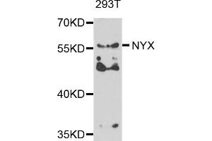 Western blot analysis of extracts of 293T cells, using NYX antibody. (Nyctalopin anticorps)