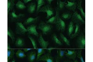 Immunofluorescence analysis of U-2 OS cells using DDX3Y Polyclonal Antibody at dilution of 1:100 (40x lens). (DDX3Y anticorps)