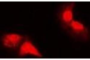 Immunofluorescent analysis of HER2 staining in MCF cells. (ErbB2/Her2 anticorps  (C-Term))