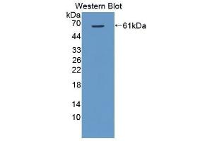 Western Blotting (WB) image for anti-VEGF Receptor 2 (VEGFR2) (AA 8-290) antibody (ABIN3206769) (VEGFR2/CD309 anticorps  (AA 8-290))