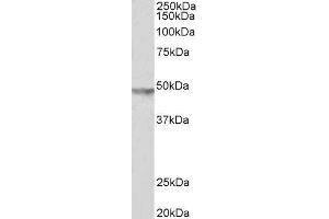 ABIN2562824 (2µg/ml) staining of Human Brain (Substantia Nigra) lysate (35µg protein in RIPA buffer). (KCNJ6 anticorps  (C-Term))