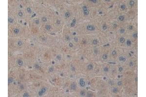 Detection of PACAP in Human Liver Tissue using Polyclonal Antibody to Pituitary Adenylate Cyclase Activating Peptide (PACAP) (Pituitary Adenylate Cyclase Activating Peptide (AA 17-176) anticorps)