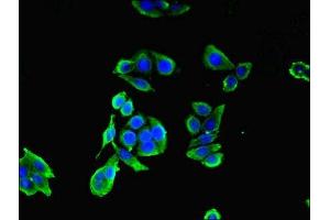 Immunofluorescent analysis of PC-3 cells using ABIN7147433 at dilution of 1:100 and Alexa Fluor 488-congugated AffiniPure Goat Anti-Rabbit IgG(H+L)