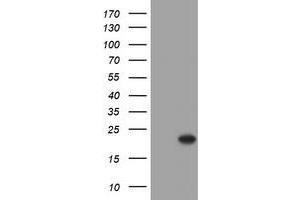 Western Blotting (WB) image for anti-Crystallin, alpha A (CRYAA) antibody (ABIN2715976)