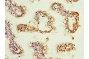 Immunohistochemistry of paraffin-embedded human small intestine tissue using ABIN7144845 at dilution of 1:100