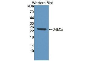 Detection of Recombinant ABI1, Human using Polyclonal Antibody to Abl Interactor 1 (ABI1) (ABI1 anticorps  (AA 1-182))