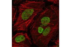 Confocal immunofluorescence analysis of Hela cells using MLH1 mouse mAb (green), showing nuclear localization. (MLH1 anticorps  (AA 381-483))