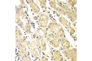 Immunohistochemistry of paraffin-embedded human gastric using PDCD2L antibody at dilution of 1:100 (x400 lens).