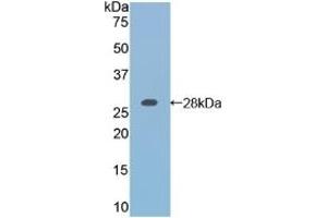 Detection of Recombinant RARa, Mouse using Polyclonal Antibody to Retinoic Acid Receptor Alpha (RARa) (Retinoic Acid Receptor alpha anticorps  (AA 237-459))