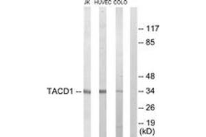 Western blot analysis of extracts from Jurkat/HuvEc/COLO205 cells, using TACD1 Antibody. (TACD1 (AA 116-165) anticorps)