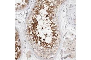 Immunohistochemical staining of human testis with C17orf97 polyclonal antibody  shows strong cytoplasmic positivity in subsets of seminiferus duct cells. (LIAT1/C17orf97 anticorps)