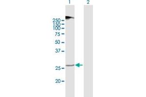 Western Blot analysis of TMEM38A expression in transfected 293T cell line by TMEM38A MaxPab polyclonal antibody. (TMEM38A anticorps  (AA 1-299))