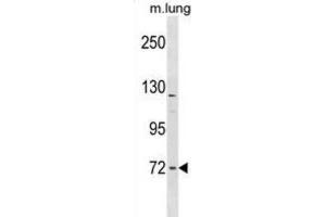 Western Blotting (WB) image for anti-Formin Binding Protein 1-Like (FNBP1L) antibody (ABIN2998844) (FNBP1L anticorps)