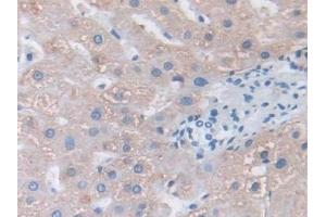 Detection of FBN1 in Human Liver Tissue using Polyclonal Antibody to Fibrillin 1 (FBN1)