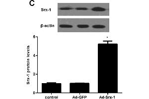 Effect of Srx-1 overexpression on SI/R-induced cell injuryH9c2 cells were transfected with the 2 nmol/l of recombinant Ad-Srx-1 or Ad-GFP prior to subject to SI/R.