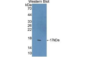 Detection of Recombinant PPARg, Mouse using Polyclonal Antibody to Peroxisome Proliferator Activated Receptor Gamma (PPARg) (PPARG anticorps  (AA 149-273))