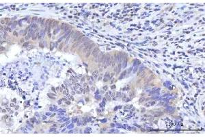 IHC analysis of RBM22 using anti-RBM22 antibody (ABIN7600268). (RBM22 anticorps  (AA 17-406))