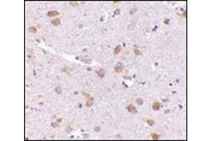 Immunohistochemistry of SATB1 in human brain with this product at 5 μg/ml. (SATB1 anticorps  (C-Term))