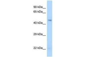 Image no. 1 for anti-Guanine Deaminase (GDA) (AA 30-79) antibody (ABIN6748002) (GDA anticorps  (AA 30-79))