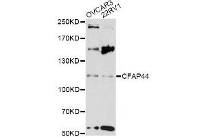 Western blot analysis of extracts of various cell lines, using CFAP44 antibody (ABIN6290455) at 1:3000 dilution. (WDR52 anticorps)