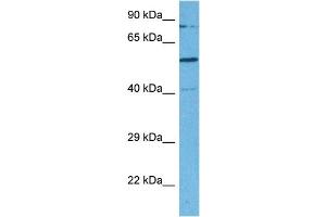Host:  Rabbit  Target Name:  SMARCD2  Sample Tissue:  Human MDA-MB-435s Whole Cell  Antibody Dilution:  1ug/ml (SMARCD2 anticorps  (C-Term))