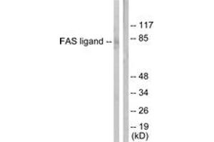 Western blot analysis of extracts from 293 cells, using FAS ligand Antibody. (FASL anticorps  (AA 101-150))