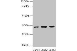 Western blot All lanes: NAPA antibody at 7 μg/mL Lane 1: 293T whole cell lysate Lane 2: Hela whole cell lysate Lane 3: K562 whole cell lysate Secondary Goat polyclonal to rabbit IgG at 1/10000 dilution Predicted band size: 34 kDa Observed band size: 34 kDa (NAPA anticorps  (AA 1-295))