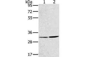Western blot analysis of A172 and A375 cell, using HSD17B12 Polyclonal Antibody at dilution of 1:650 (HSD17B12 anticorps)