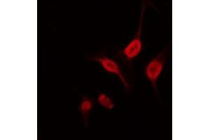 ABIN6266920 staining 293 by IF/ICC. (NEUROD2 anticorps  (Internal Region))