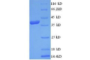 SDS-PAGE (SDS) image for Annexin A1 (ANXA1) (AA 5-346), (partial) protein (His tag) (ABIN1046548) (Annexin a1 Protein (AA 5-346, partial) (His tag))
