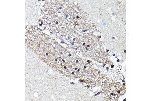 Immunohistochemistry of paraffin-embedded human brain using NMDA Rabbit mAb (ABIN7267420) at dilution of 1:100 (40x lens). (NMDAR2A anticorps)