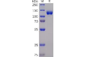 Human E Protein, mFc-His Tag on SDS-PAGE under reducing condition.