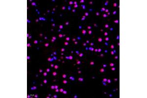Immunofluorescence of paraffin embedded mouse brain using RBAK (ABIN7075383) at dilution of 1:400 (400x lens) (RBAK anticorps)