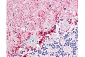 Anti-FABP7 / BLBP antibody IHC of human brain, cerebellum.