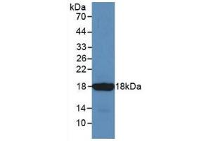 Detection of Recombinant SST, Mouse using Monoclonal Antibody to Somatostatin (SST)